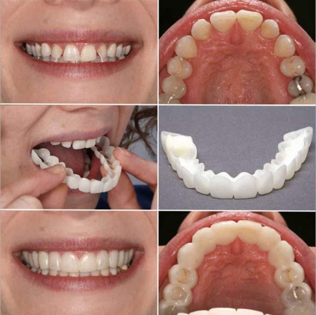 Smile with Confidence – Easy-to-Fit Cosmetic Denture Teeth