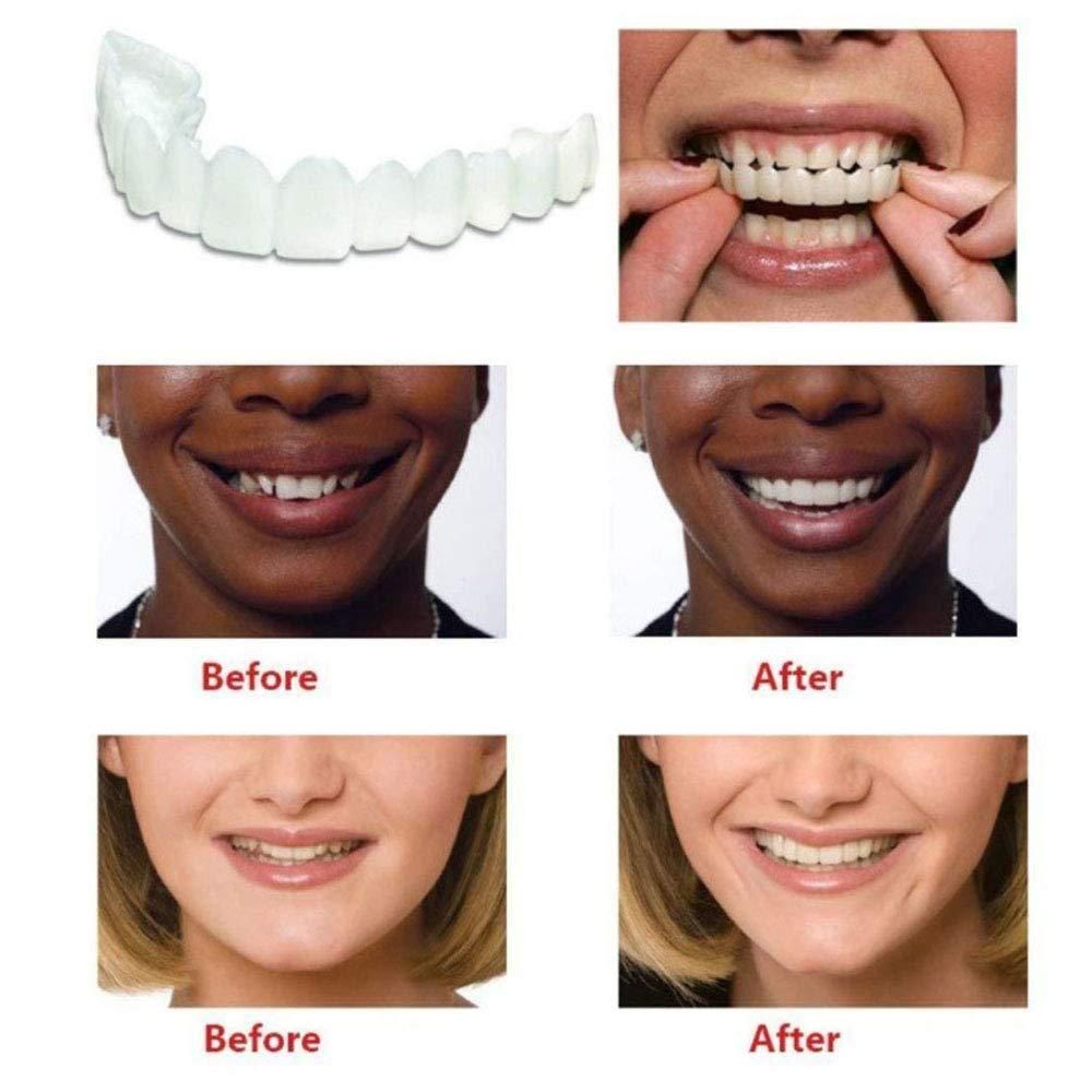 Smile with Confidence – Easy-to-Fit Cosmetic Denture Teeth